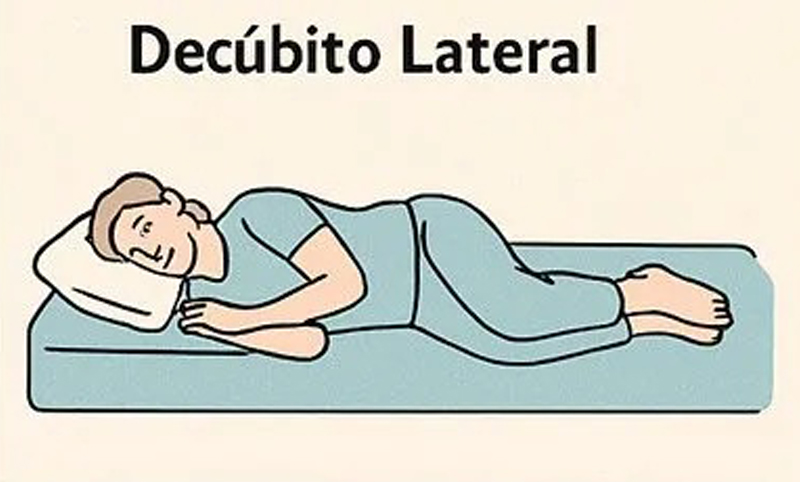 decubito lateral